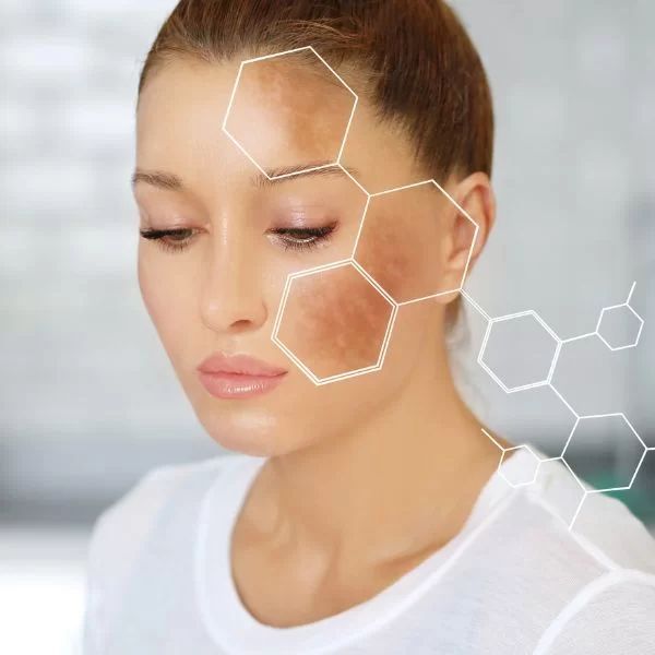 /uploads/blog/tratamente-leziuni-pigmentare-ploiesti-dermatologie.jpg