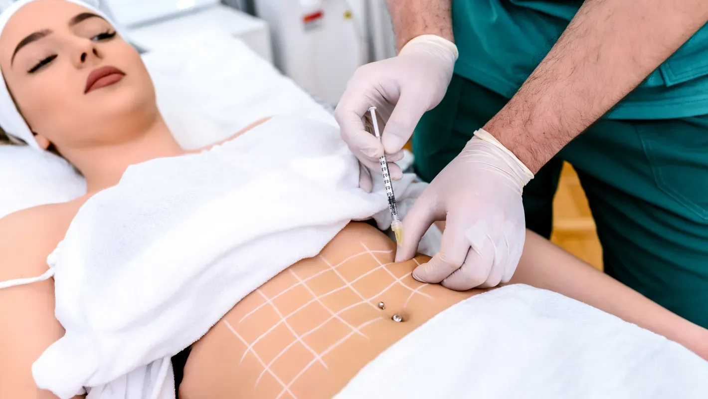 lipoliza-injectabila-1.webp